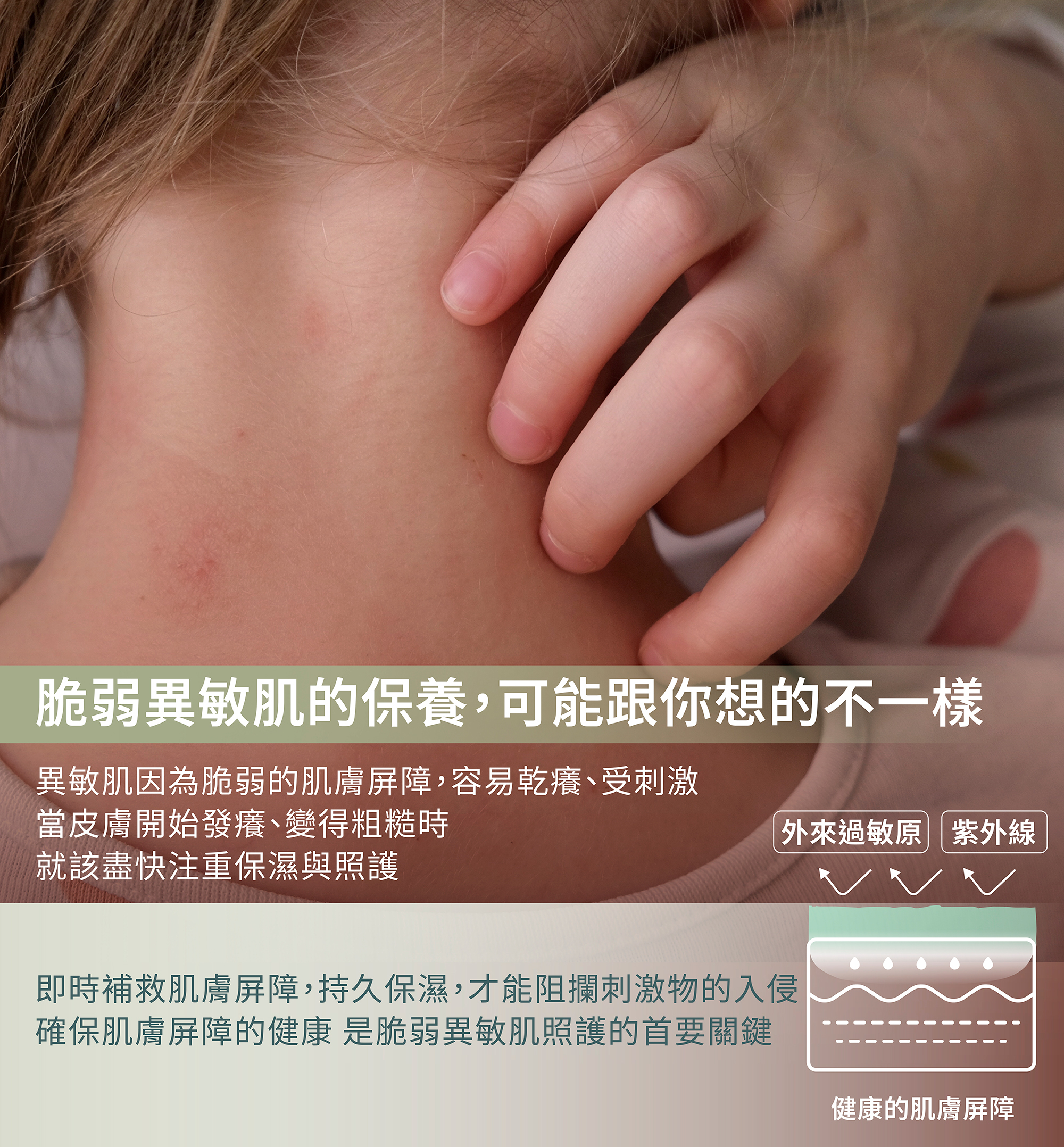 過敏乳霜,中度過敏,乾癢過敏,修護肌膚,寶寶保濕乳霜