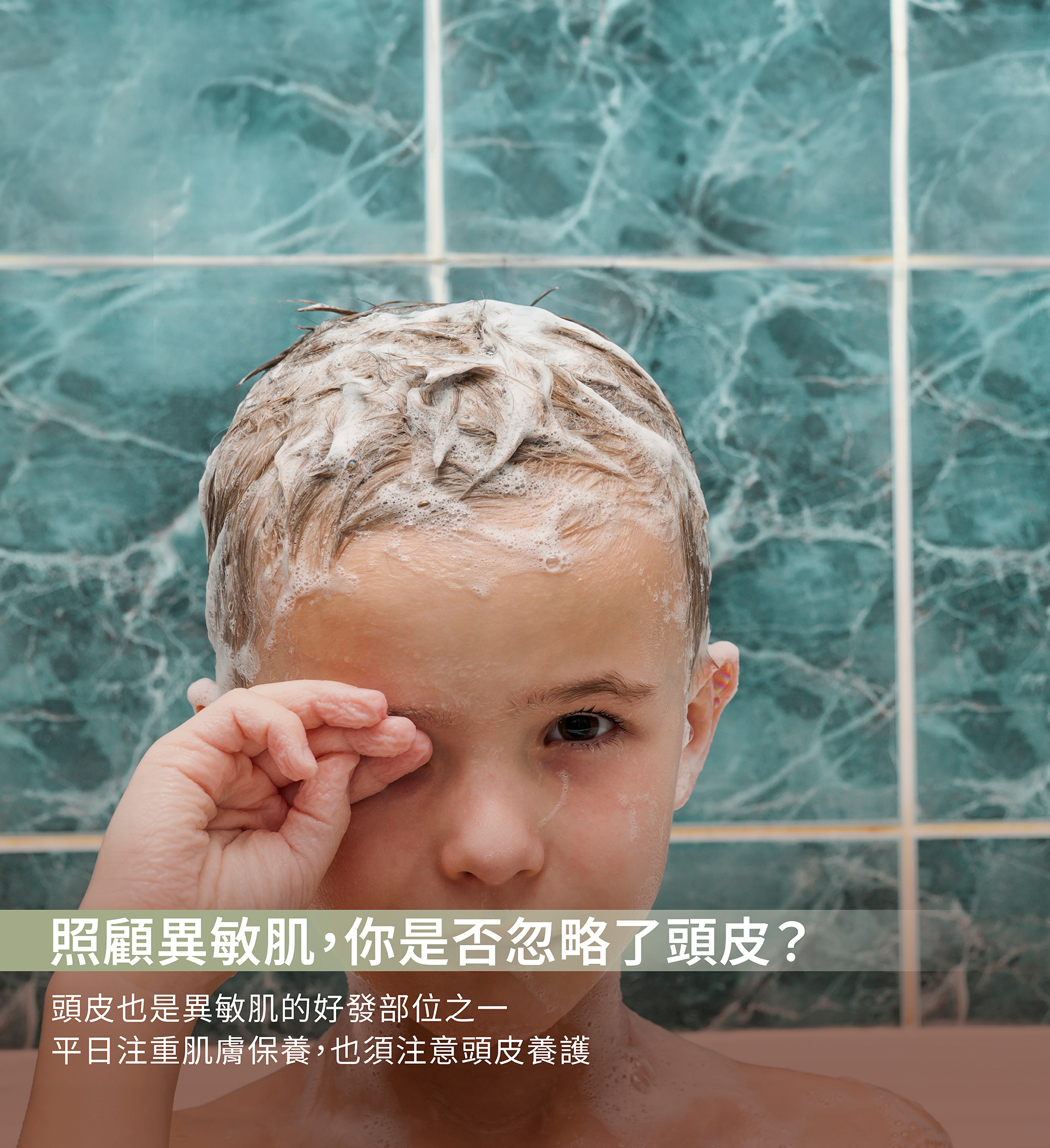 脂漏性頭皮,頭皮癢,植物配方洗頭,洗髮精,頭皮屑,寶寶頭癢,囟賽,油頭