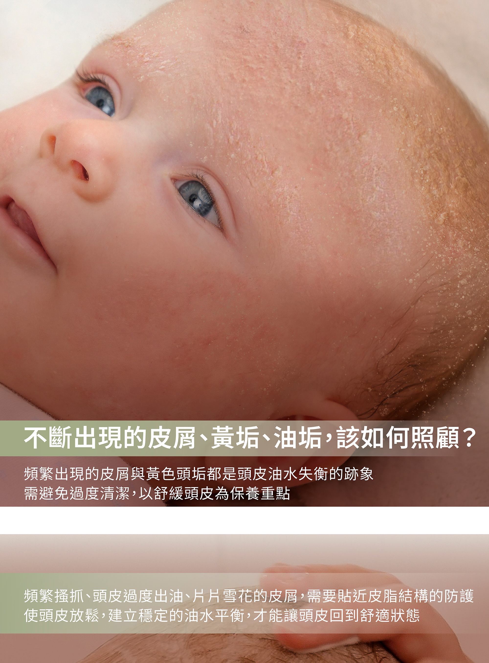 脂漏頭皮,敏感頭皮保濕,敏感頭皮按摩,純植物保養,植物油