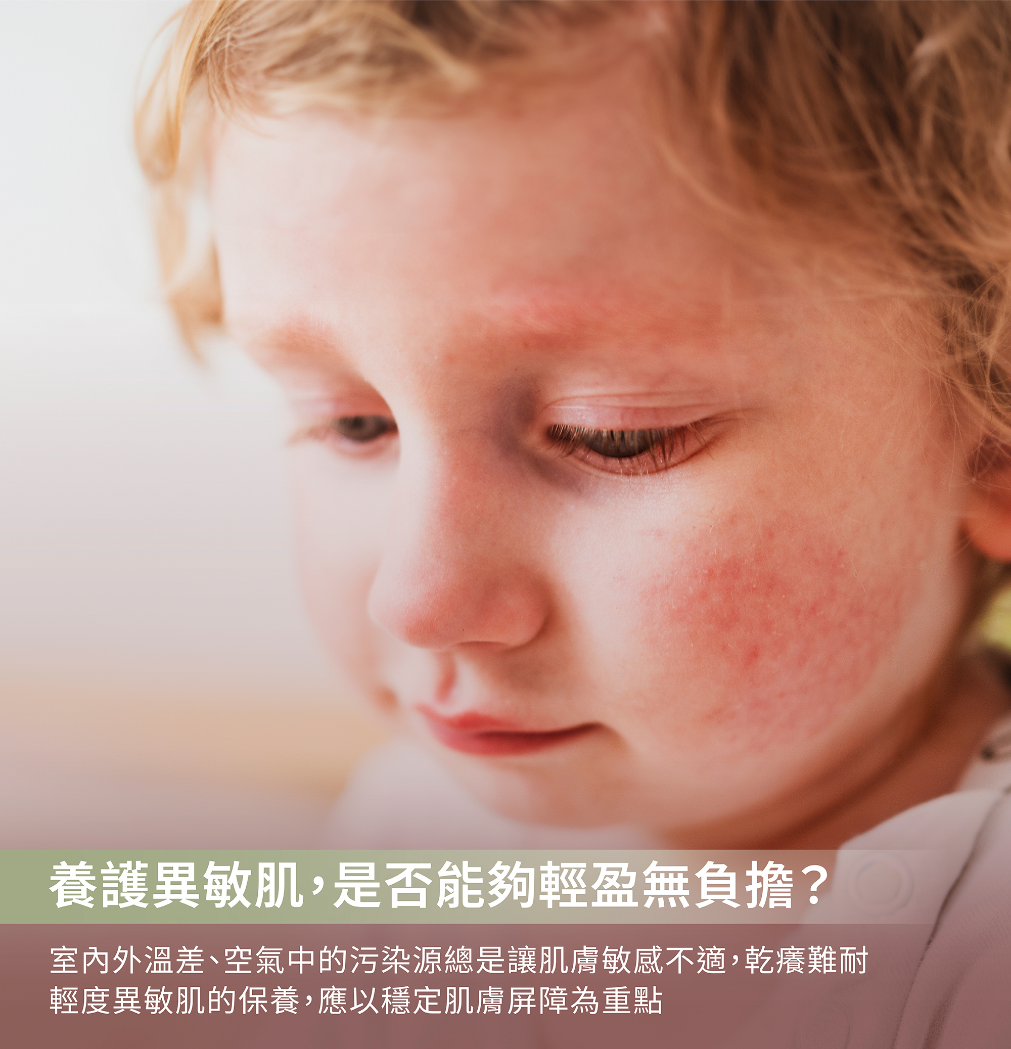 過敏乳液,輕度過敏,乾癢過敏,熱汗疹,輕度過敏肌膚