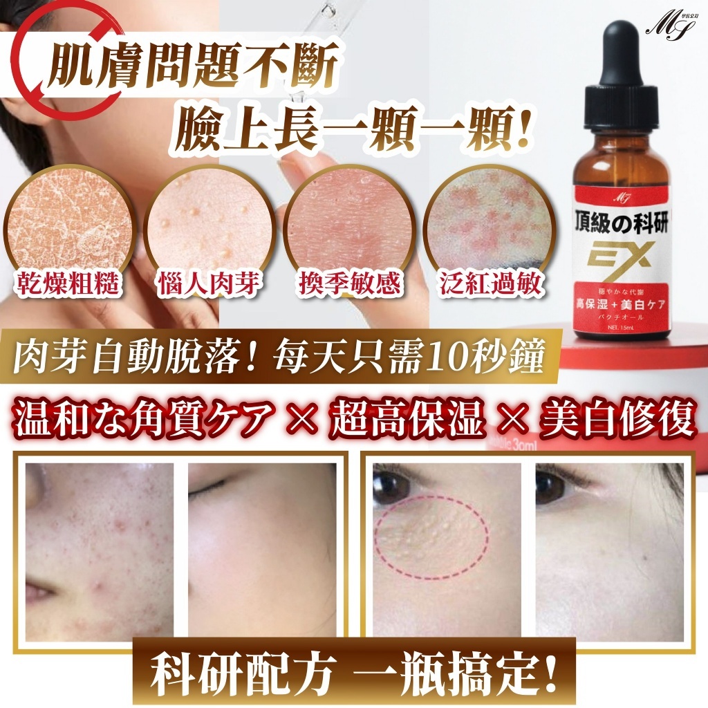 頂級科研 肉芽角質EX護理美容液