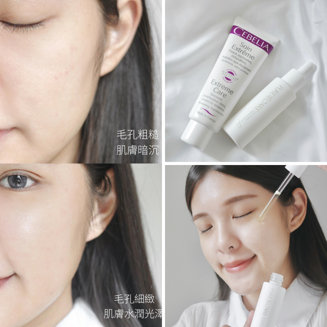 聚光煥顏酸精華