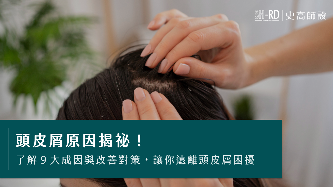 頭皮屑原因揭祕！了解9大成因與改善對策，讓你遠離頭皮屑困擾