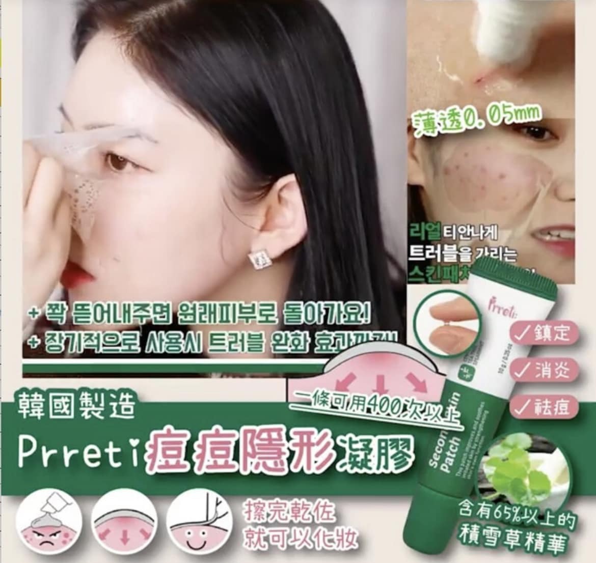 【預訂】AQ090912 韓國 Prreti 痘痘液態暗瘡貼 (10g*2支裝)