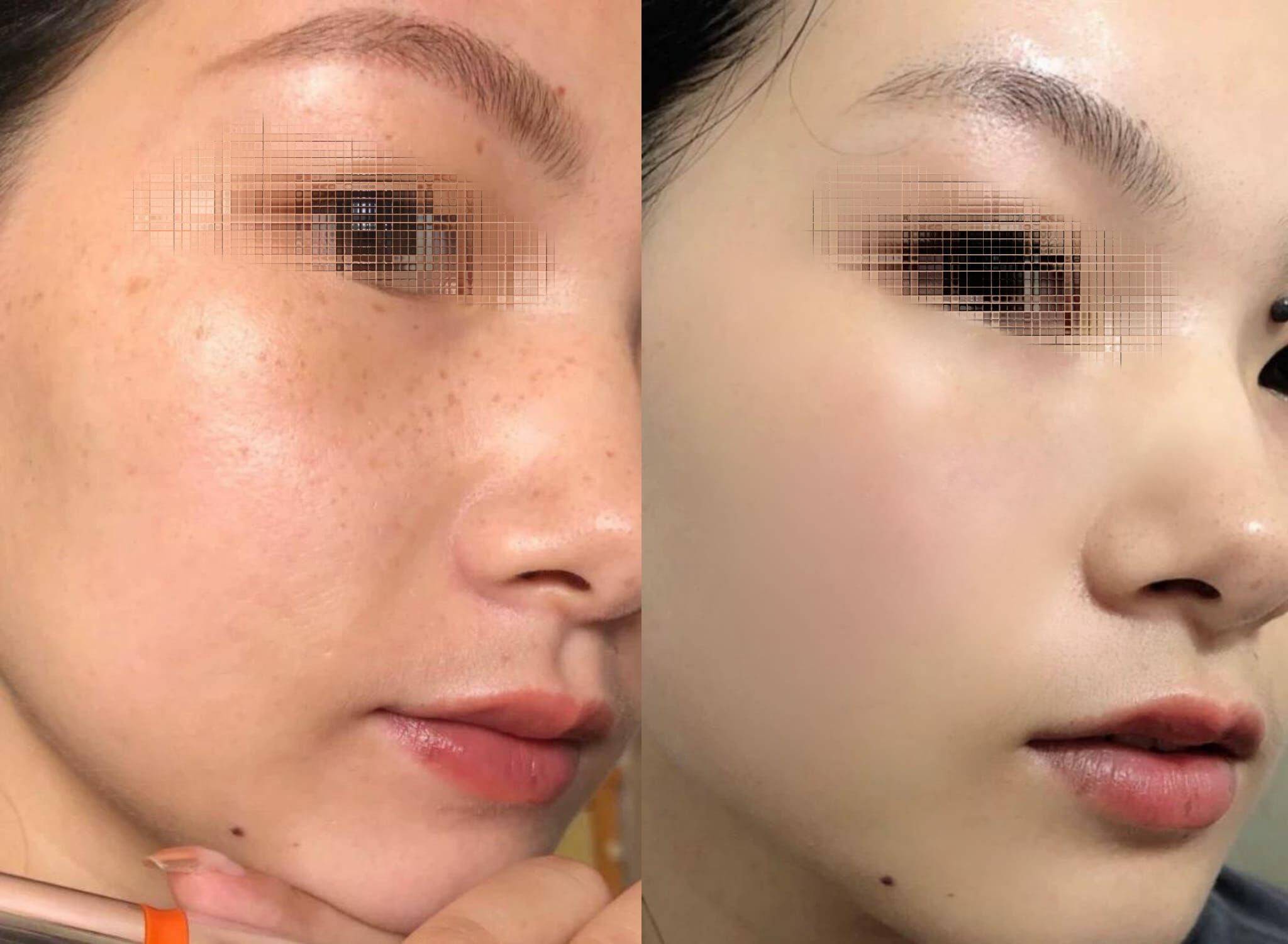 ( 使用導入儀專用美白 ) 3D亮白・斑點隱形・黃氣退散| Labalme - Les-soins 美容院清零射頻霜100g R693✨溫馨提示✨💢產品是供應商一次性推出少量優惠，所以不能提供存貨服務，敬請留意💢