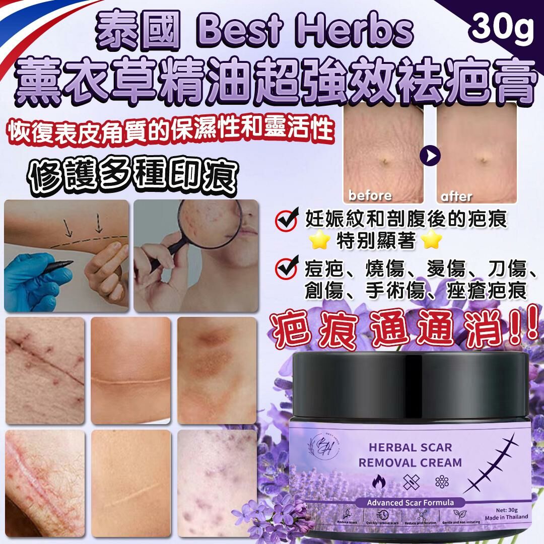 泰國 Best Herbs 薰衣草精油超強效袪疤膏