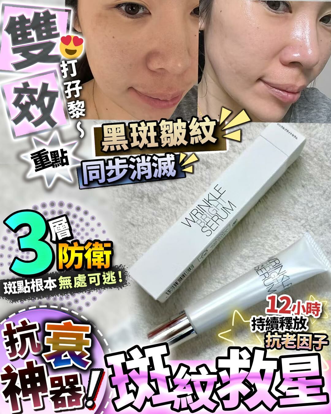 💥日本 斑紋救星 20g