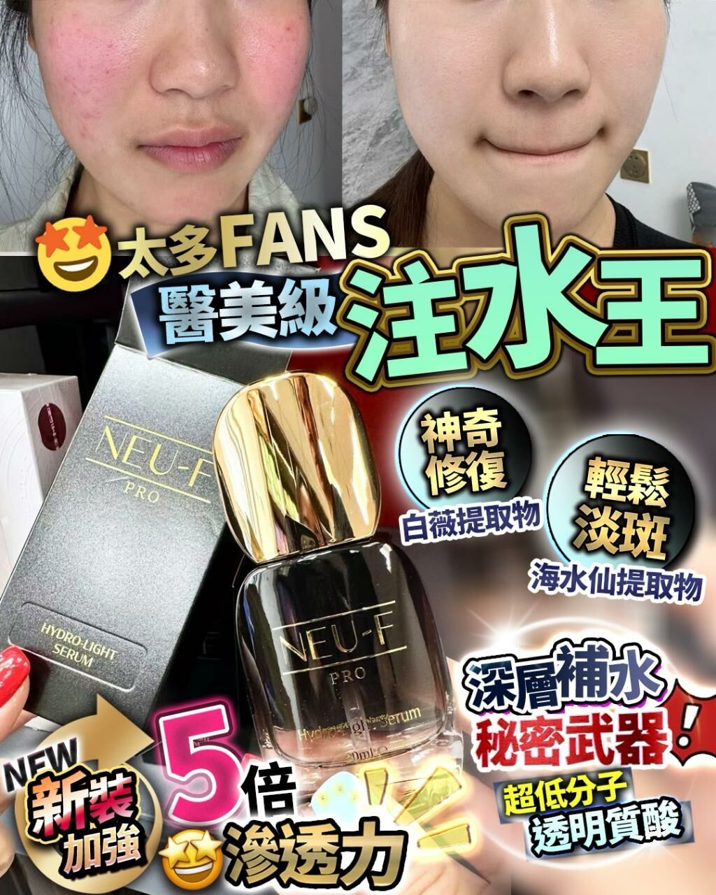 新版‼️NEU-F 注水王 30ml
