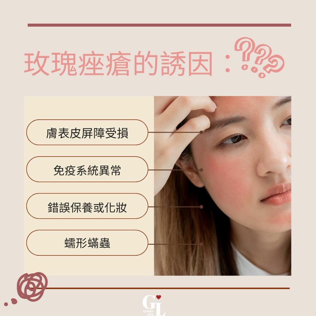 玫瑰痤瘡的誘因