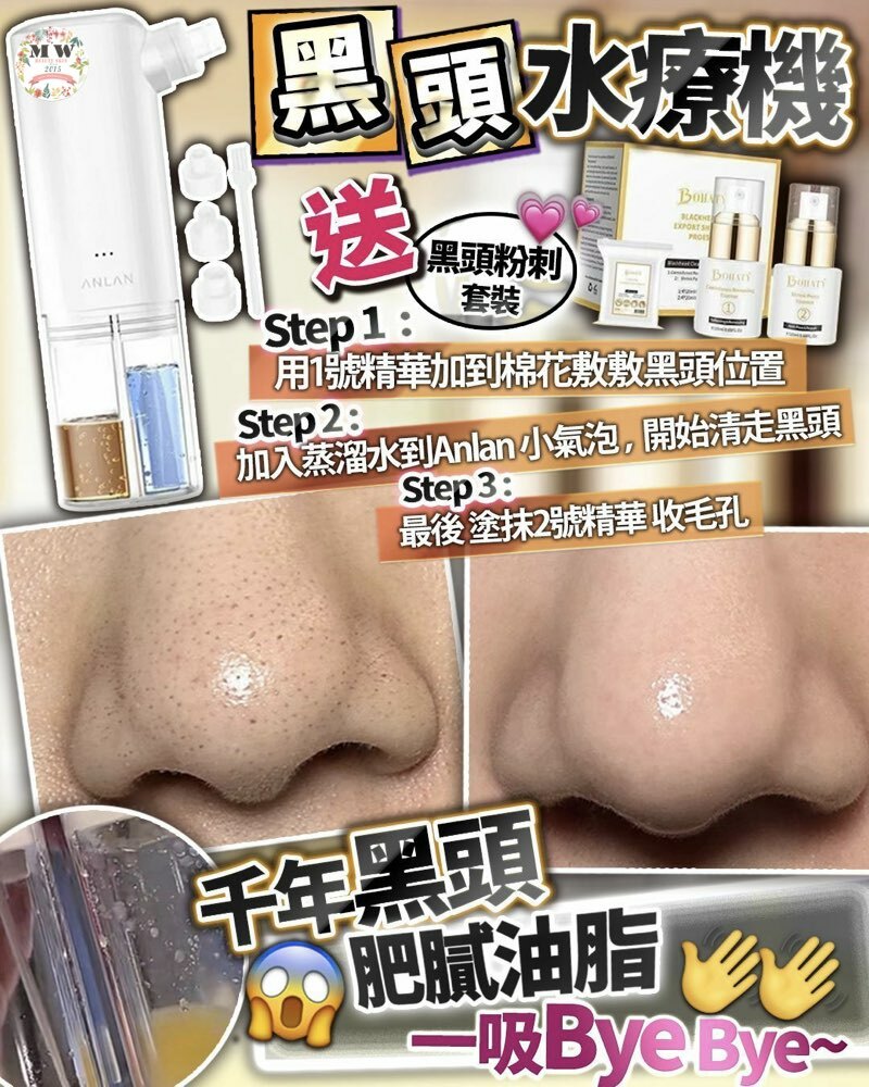 Anlan 黑頭水療機 🌟送黑頭粉刺套裝