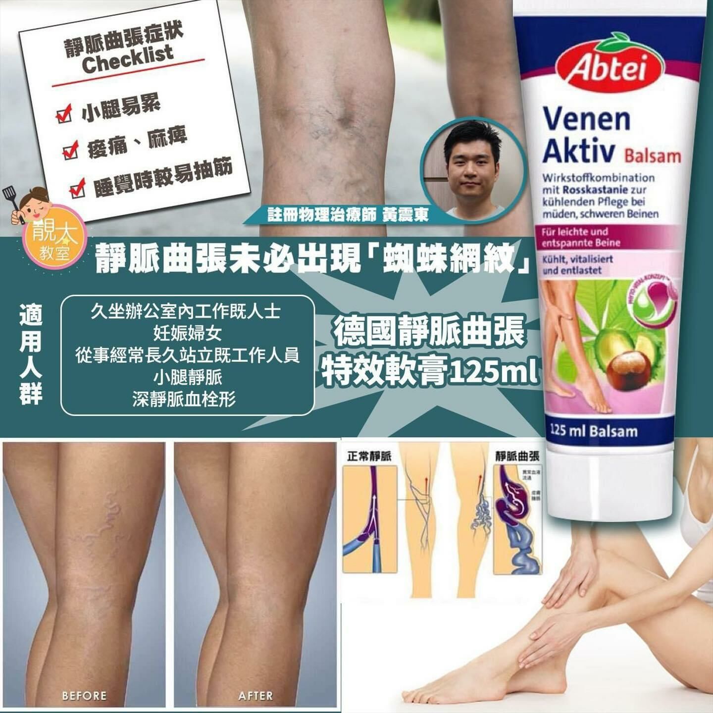 德國Abtei 靜脈曲張特效軟膏