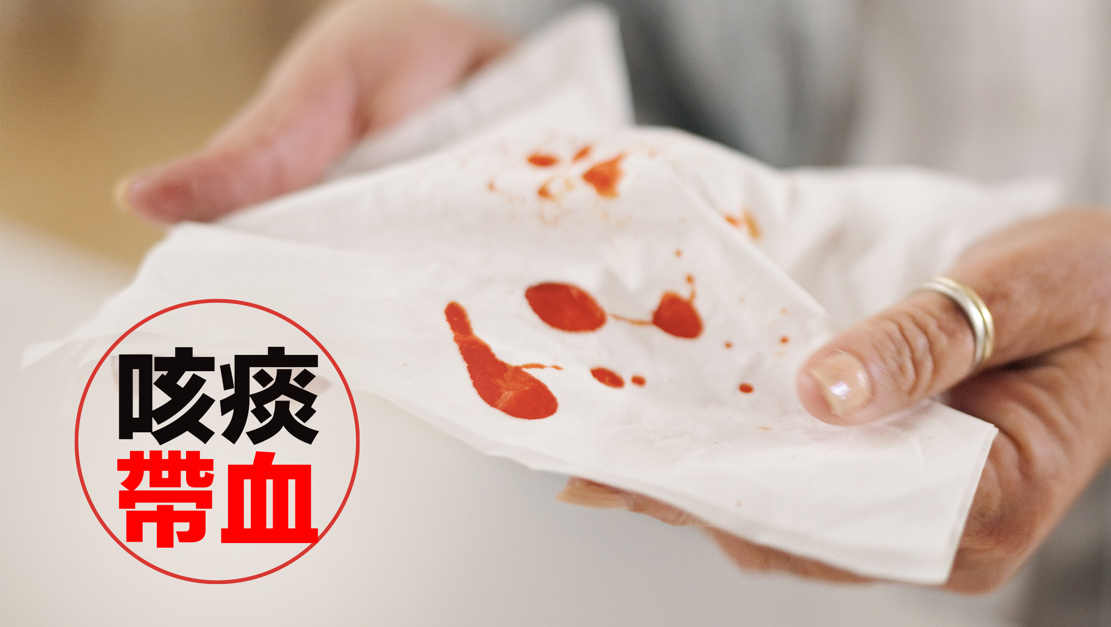 咳痰帶血：咳痰中帶血是肺患常見的警號。即使血量很少，也應該立即就醫檢查，這可能是因為肺部異細胞導致血管破裂所引起。
