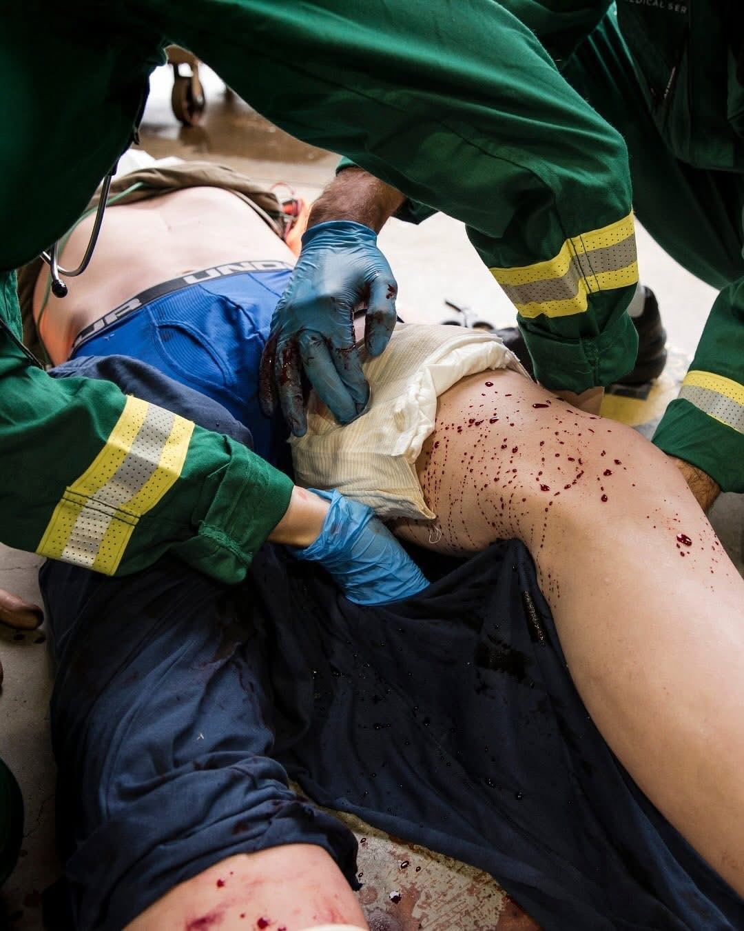 「醫護人員正對傷者大腿根部進行填塞止血處置，使用戰術醫療紗布處理 junctional wound 大量出血」