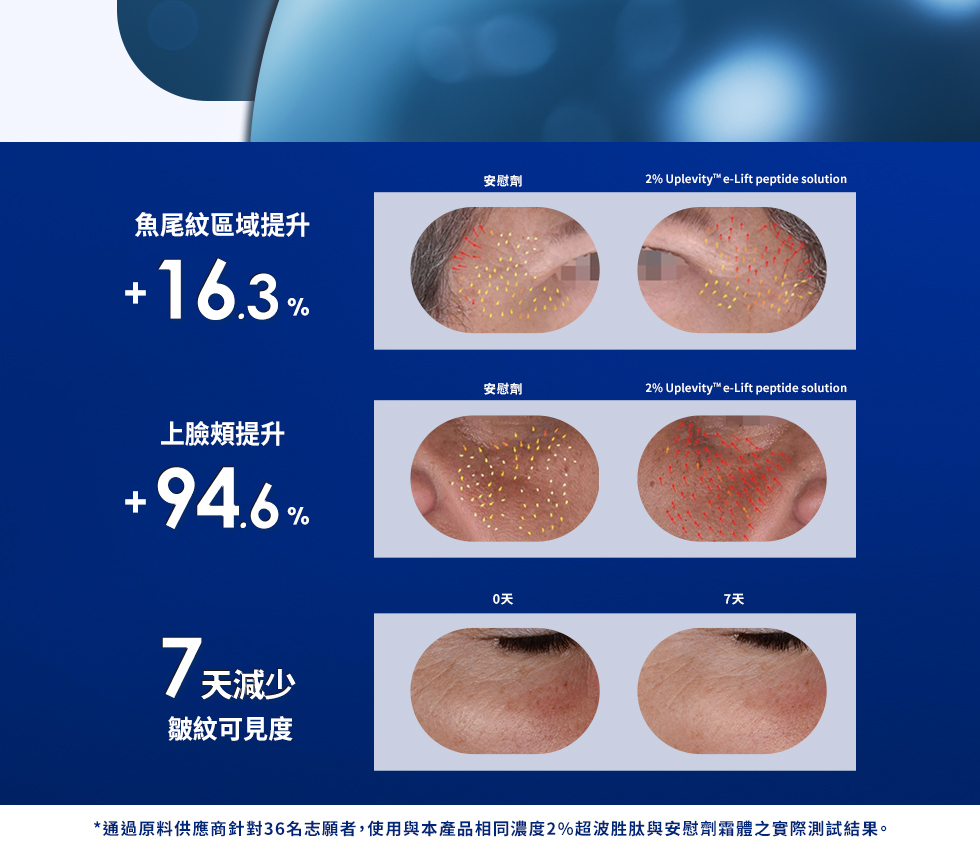 魚尾紋區域提升 %上臉頰提升94.6%7天減少皺紋可見度安慰劑2% Uplevity™e-Lift peptide solution安慰劑2% Uplevity™ e-Lift peptide solution0天7天*通過原料供應商針對36名志願者,使用與本產品相同濃度2%超波胜肽與安慰劑霜體之實際測試結果。