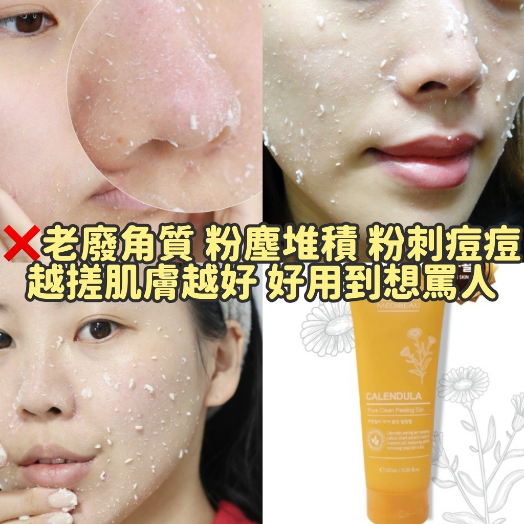 韓國 金盞花淨膚去角質凝膠 （1套2支）