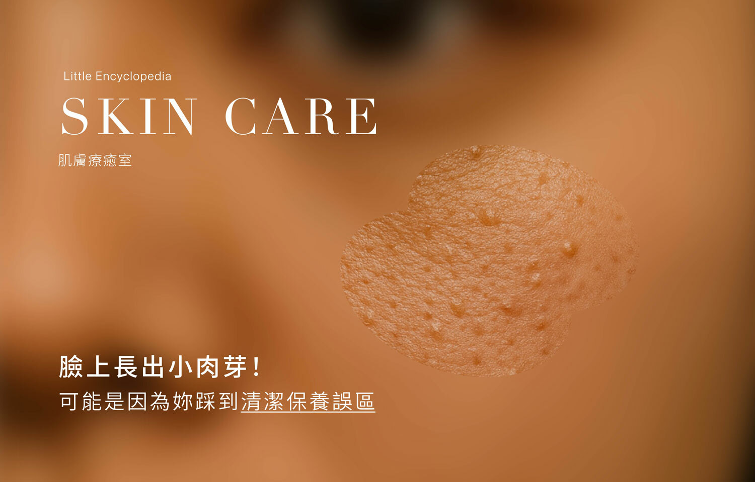 臉上長出小肉芽！可能是因為妳踩到清潔保養誤區