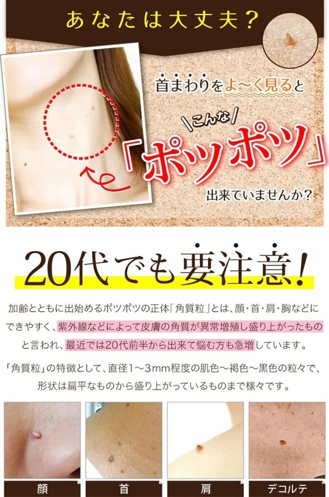 Ipocare EX 除疣專用美容液