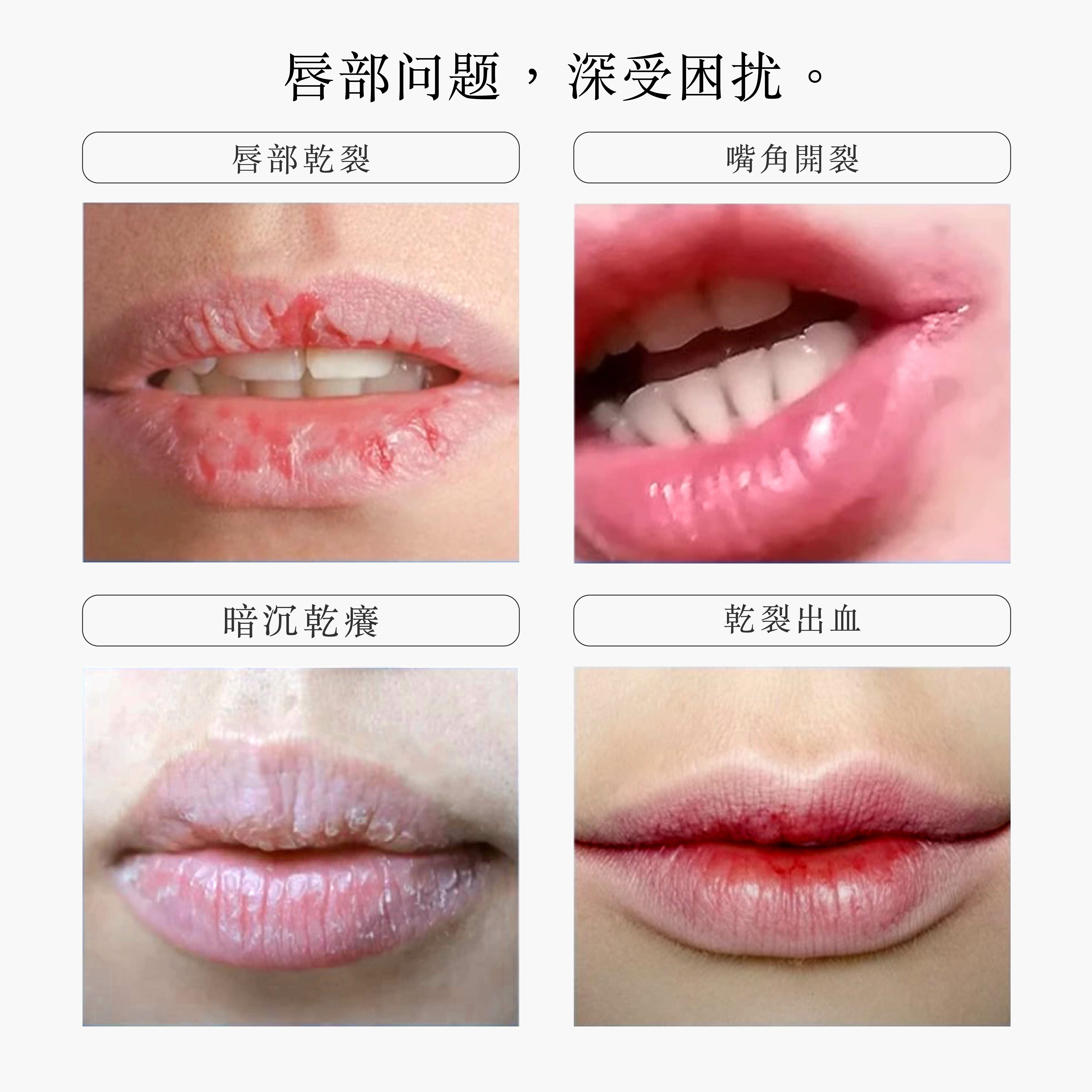 【現貨】KYOGOKU LL041927 去唇紋精華液(嘟嘟棒)