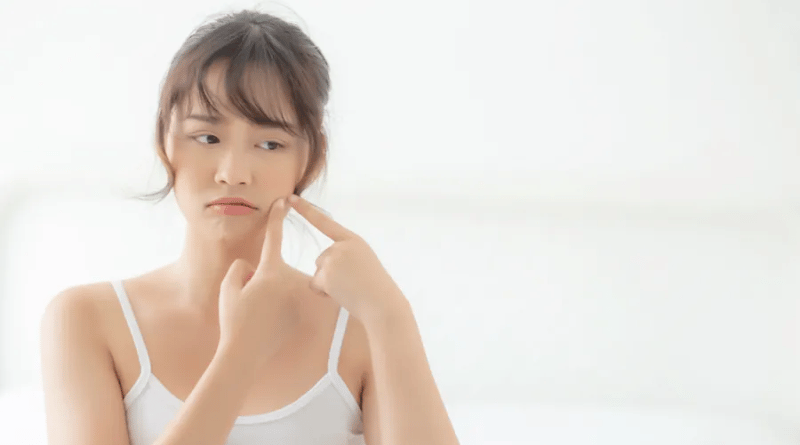 【保養小技巧】紅腫痘痘好困擾！掌握５個舒緩和改善的關鍵技巧｜逗DOLLSPA