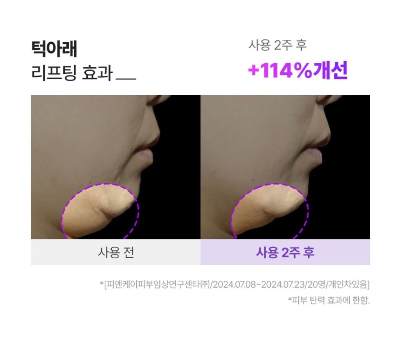 🇰🇷BOH 3D V臉提拉面膜