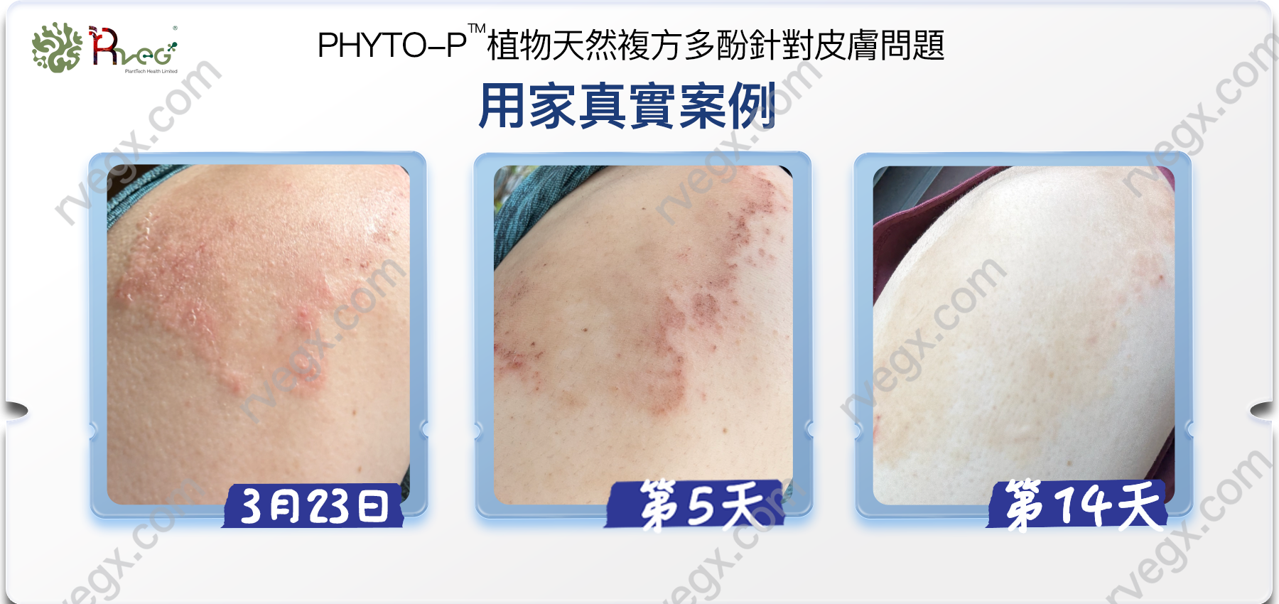 用家肌膚改善效果