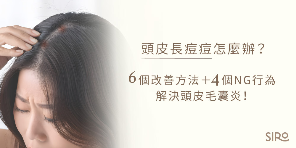 頭皮長痘痘怎麼辦？6個改善方法與4個NG行為，解決頭皮毛囊炎！
