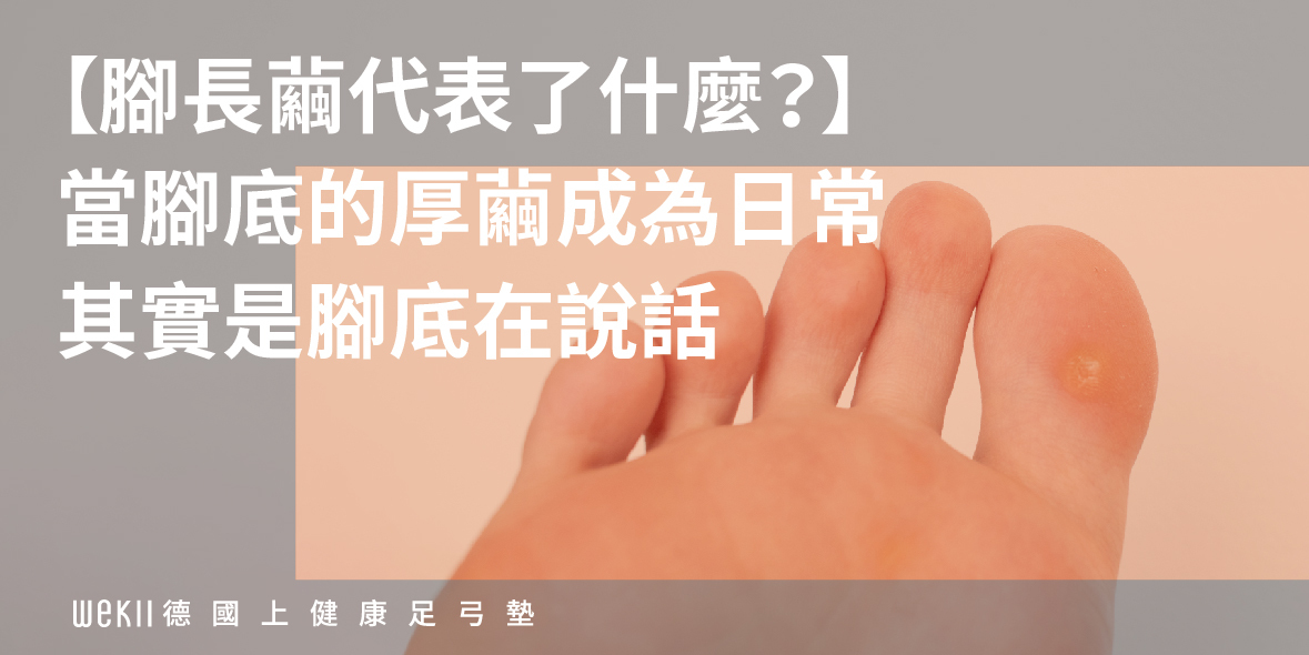 腳長繭文章首圖