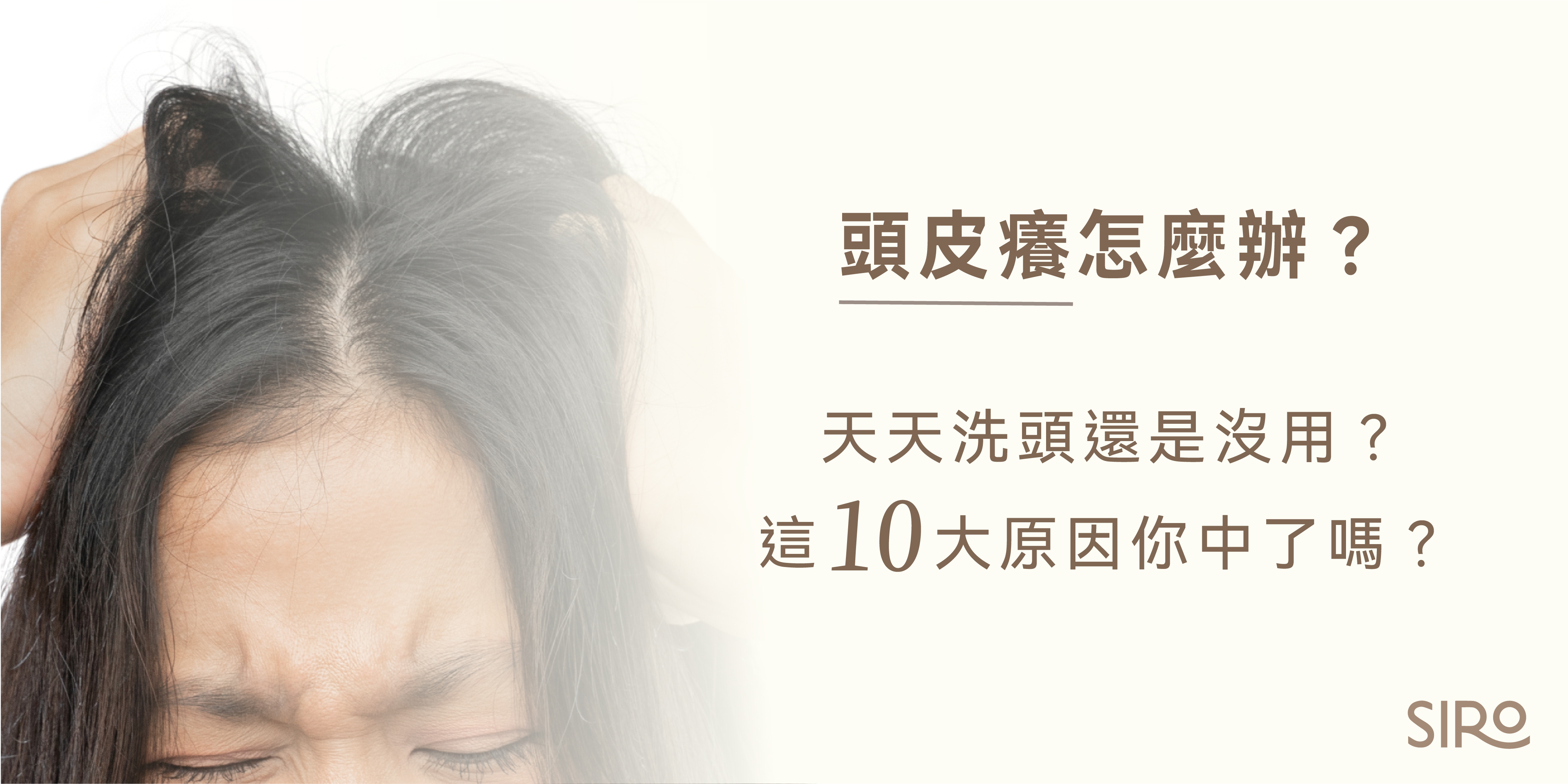 頭皮癢怎麼辦？天天洗頭還是沒用？這10大原因你中了嗎？