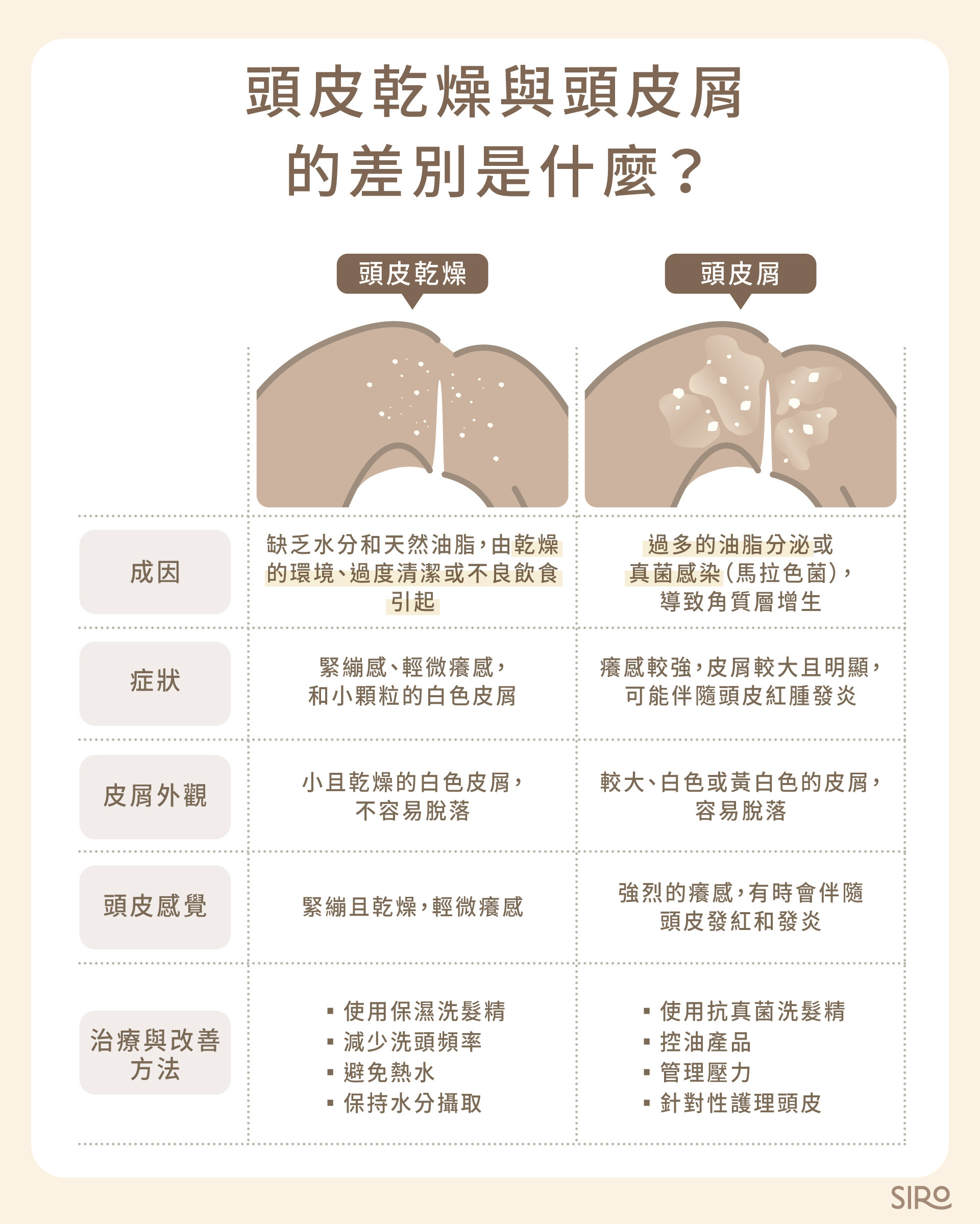 頭皮乾燥與頭皮屑的差別是什麼？