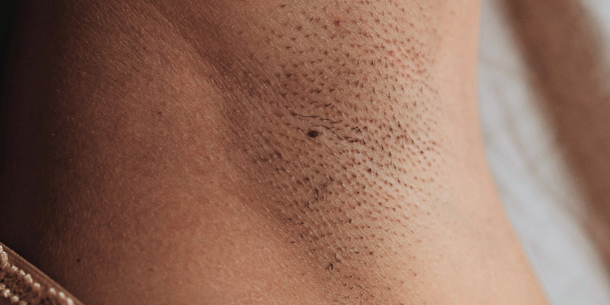 內嵌毛不要來！居家脫毛解決方案，學會除毛後去角質，影響肌膚美觀，還會帶來紅腫、發癢與不適的問題。幸好，只要掌握正確的除毛方式與去角質技巧，就能有效預防內嵌毛，維持肌膚光滑與健康