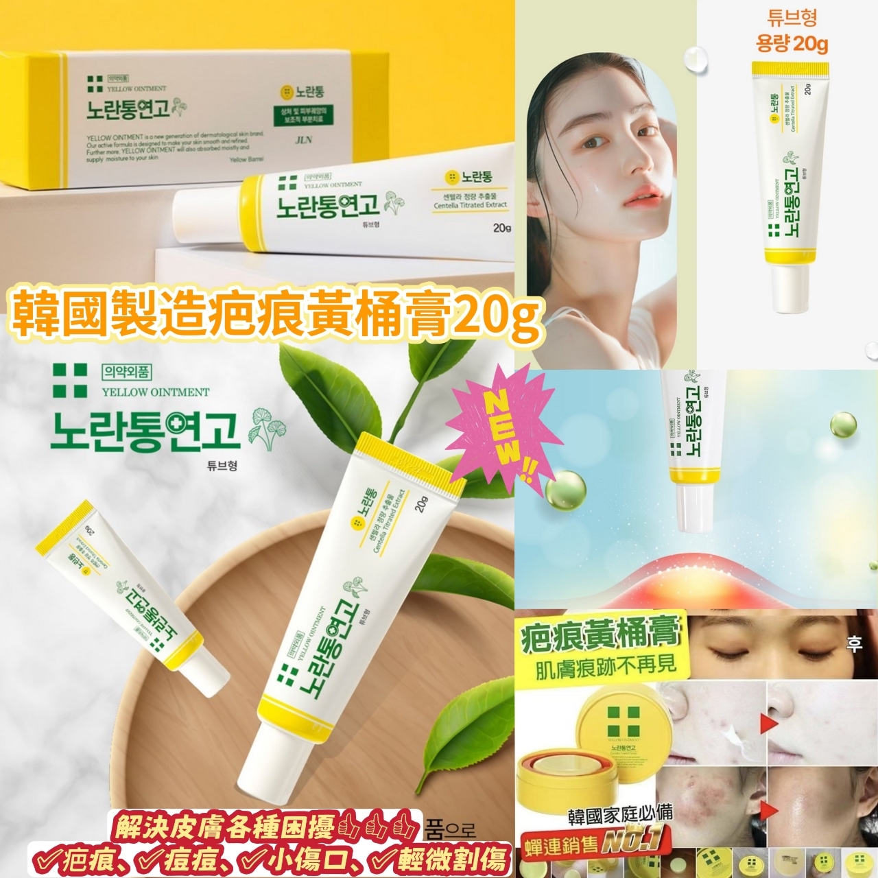 韓國製造疤痕黃桶膏