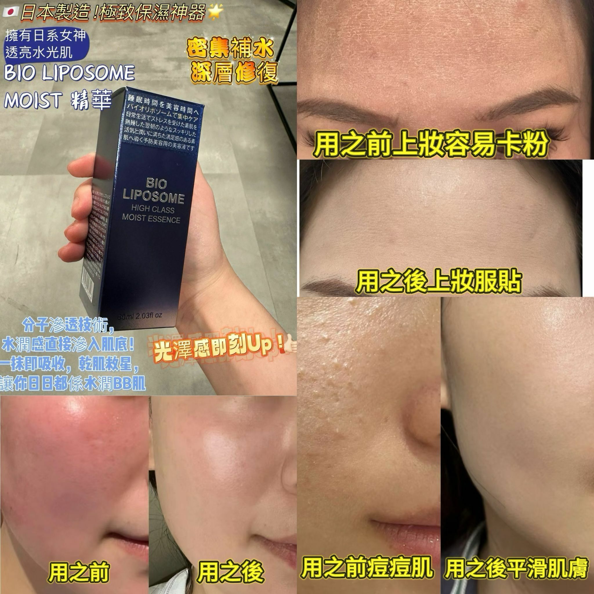 【現貨】日本醫美株式會社 ABL G042801 安瓶系列 60ML