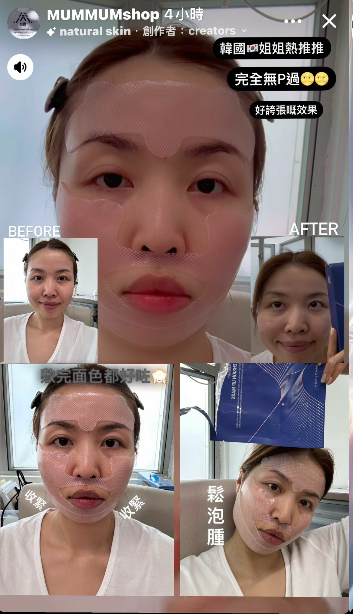 SS204/MEDITHERAPY/V臉塑顏面膜優先下單優惠 $199/1盒5片 即時下單-$10/同時享有包郵回分享圖先有包郵