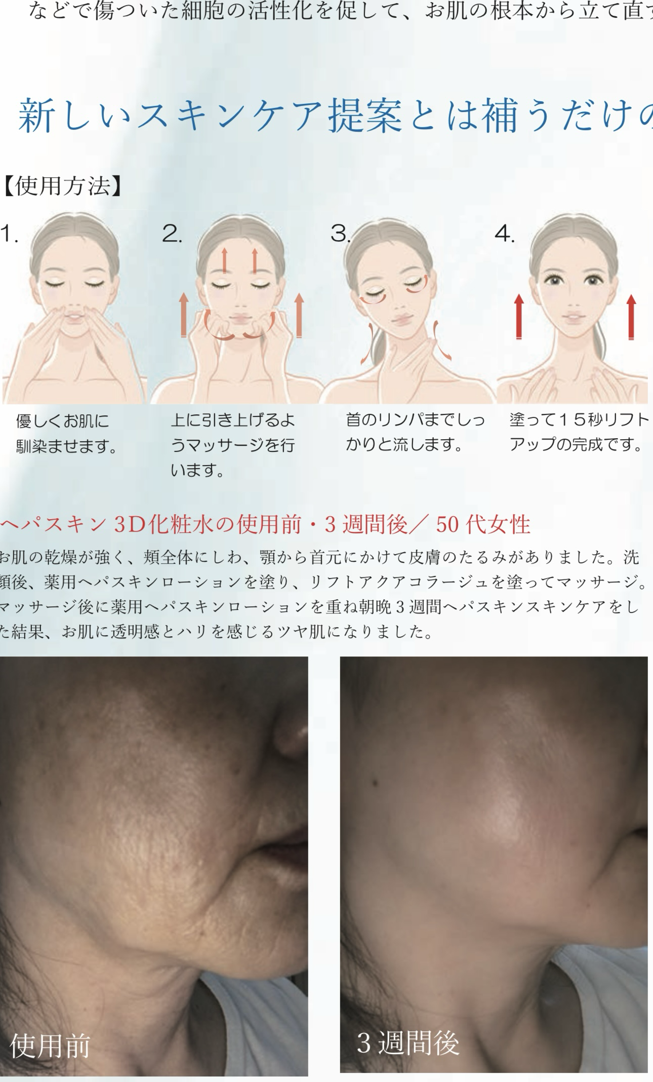 【現貨】HEPASKIN LL043001 3D 拉皮精華液 150ml
