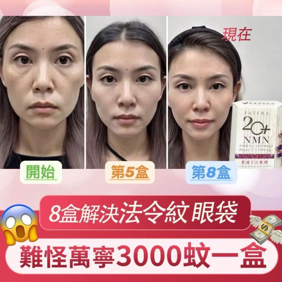 日本Fatera 20+ NMN 30粒/盒 [#SQ25050201]