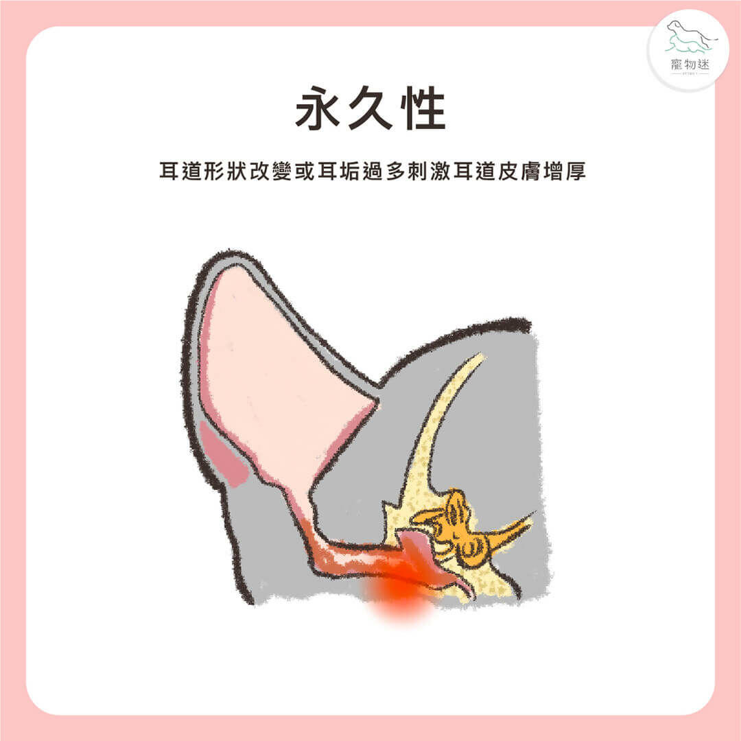 永久性外耳炎