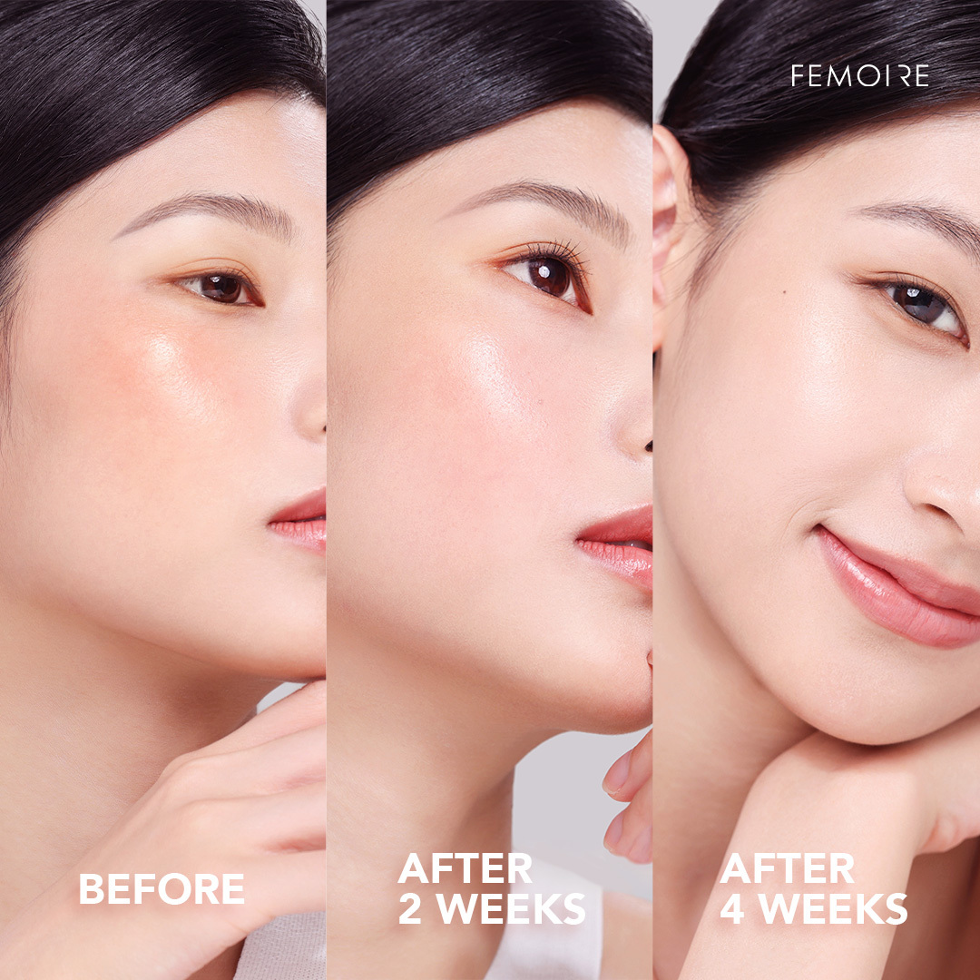 FEMOIRE 玫瑰花胎素