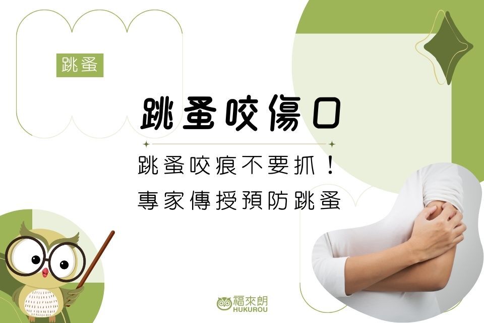 被跳蚤咬傷口長怎樣？跳蚤咬痕不要抓！專家傳授5招預防跳蚤