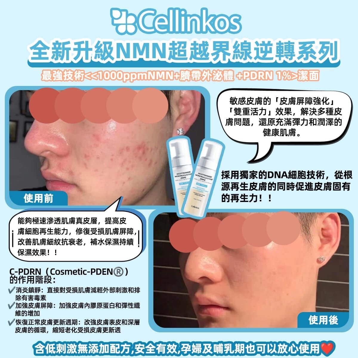 Cd6702   Cellinkos 202w5升級NMN人魚針潔面  ✨️限時附送8000轉潔面除角質儀
