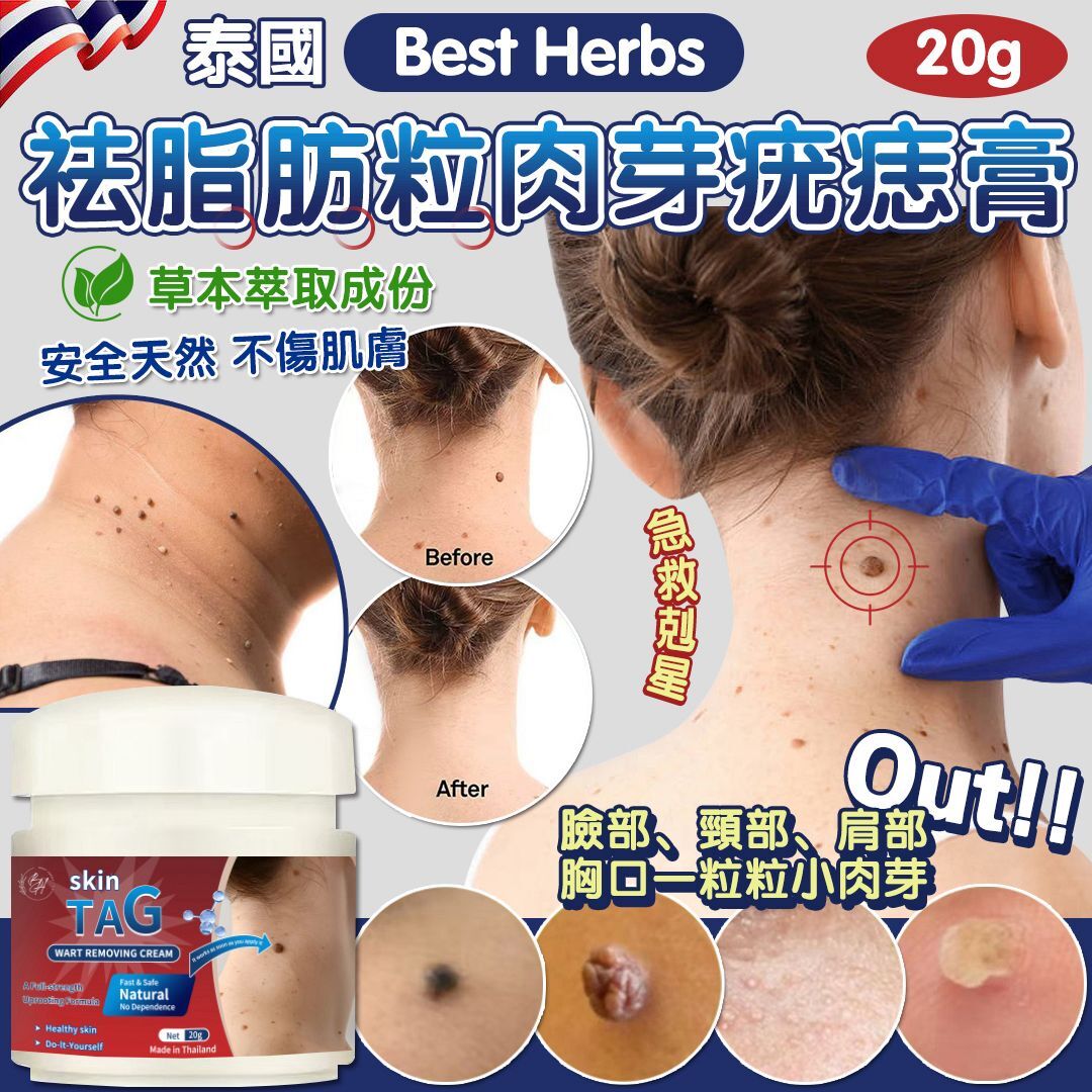 泰國 Best Herbs 祛脂肪粒肉芽疣痔膏