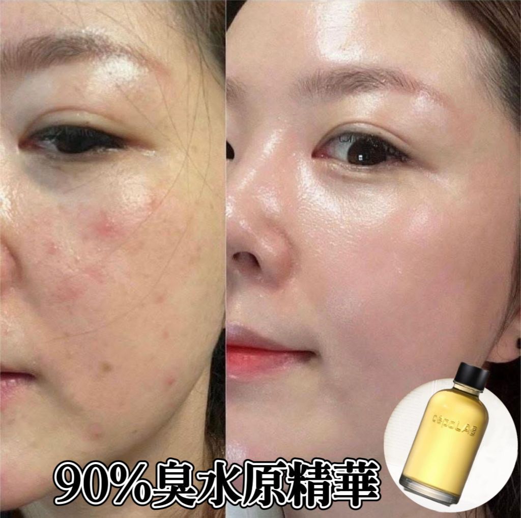 韓國 CepoLab 90% 臭水原精華 [#SQ25050902]