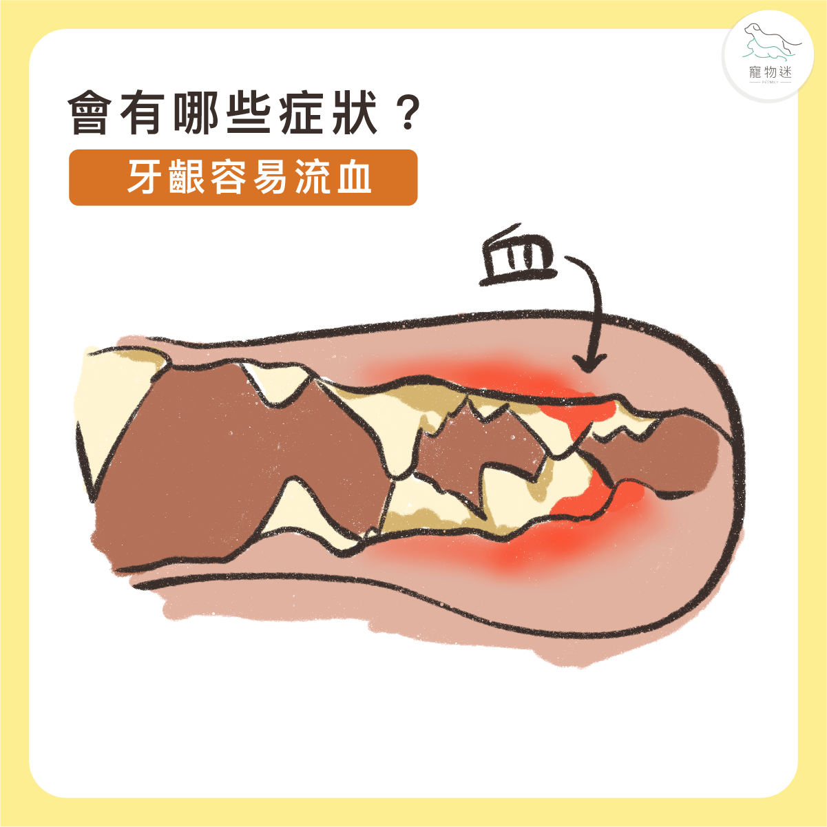 牙齦易出血