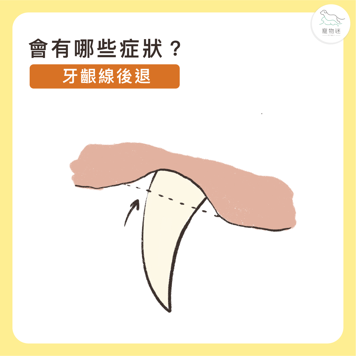 牙齦線有後退跡象
