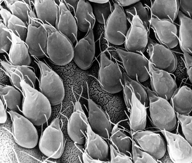 什麼是梨形鞭毛蟲感染（Giardia）