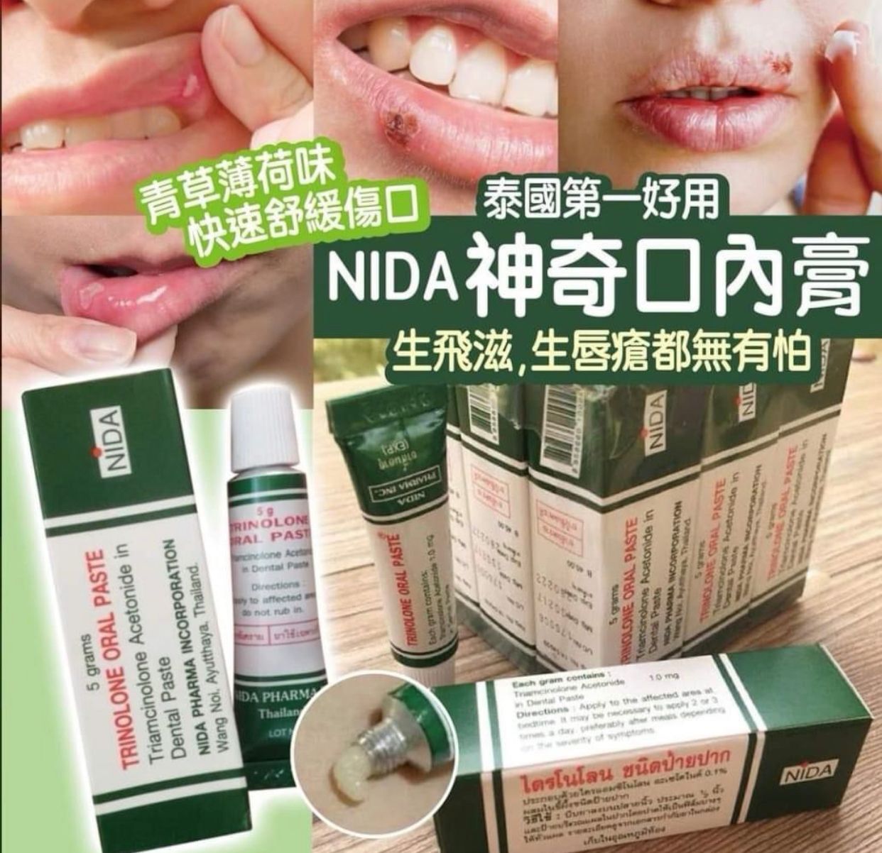 【預訂】AM10008 泰國 NIDA 神奇痱滋膏 5g