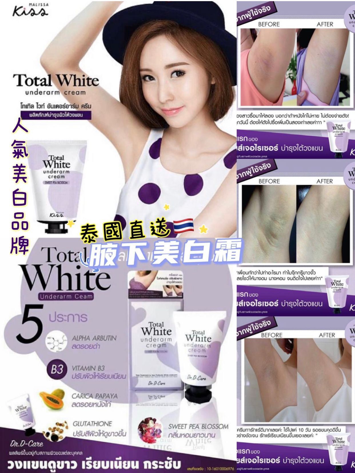 【預訂】AM10009 泰國 Total White Underarm Cream 腋下美白霜 30ml