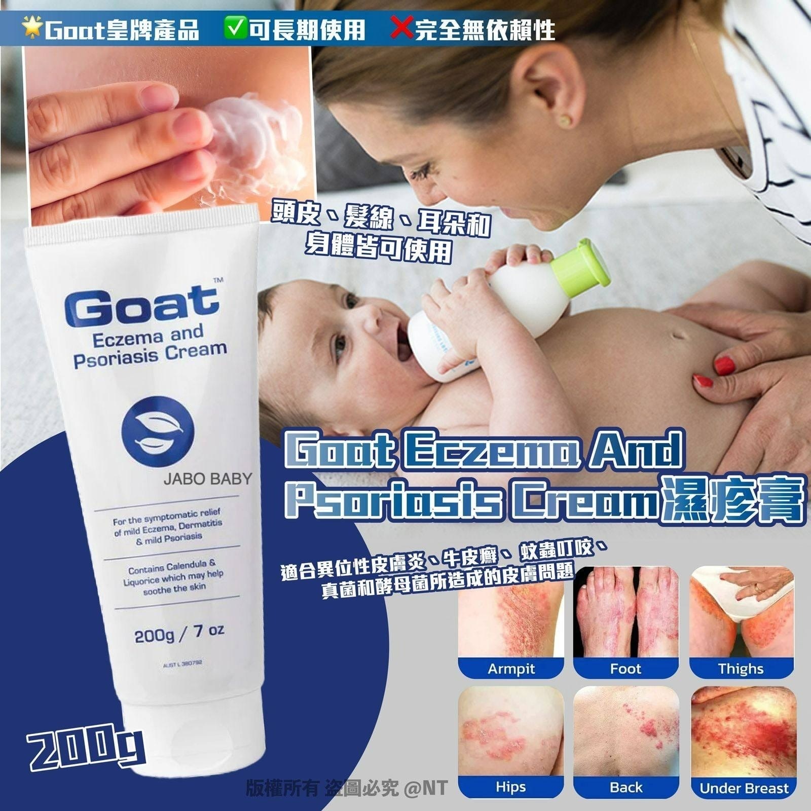 Goat Eczema And Psoriasis Cream濕疹膏200g
