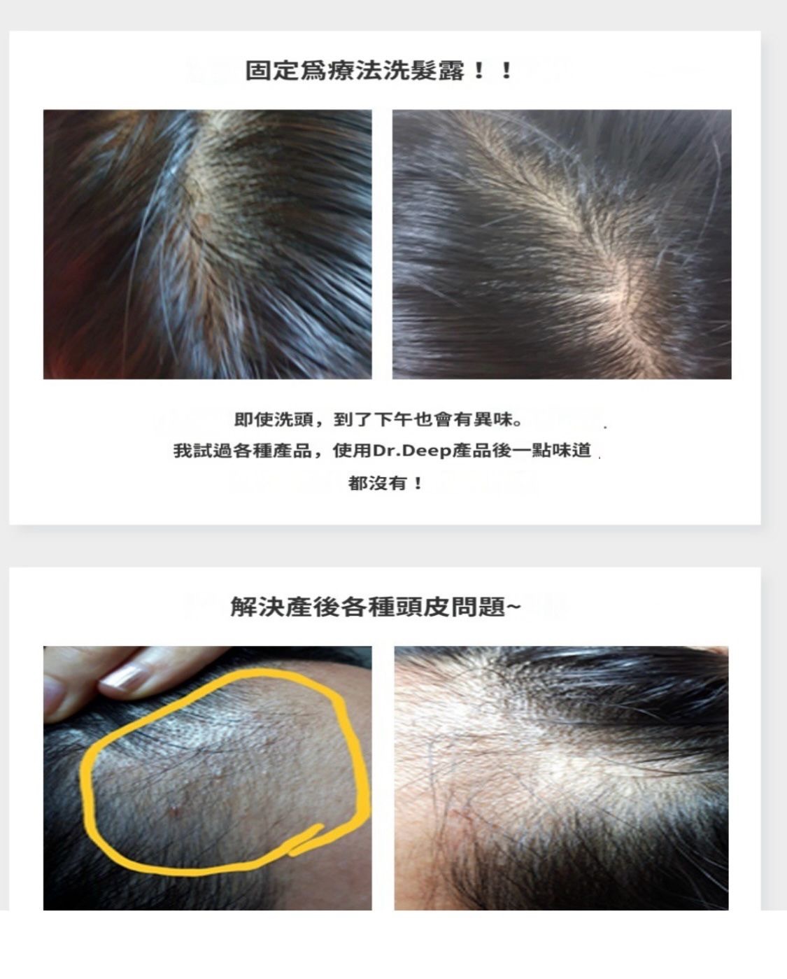 DR.DEEP - 保濕療法洗頭水