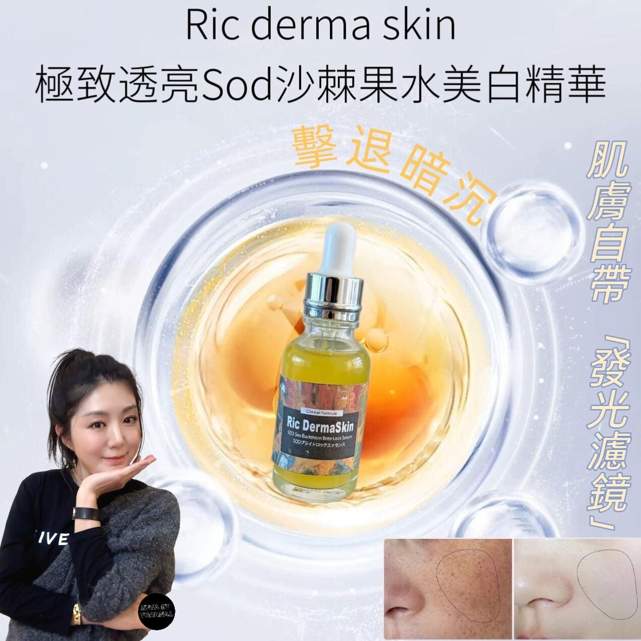 （白淨水潤）Ric derma skin極致透亮 深層水潤Sod沙棘果水美白精華30ml R953☀️suki著數優惠Ric 精華買四送三☀️任選7件💢產品不予存貨，一次性推出少量優惠，敬請留意💢