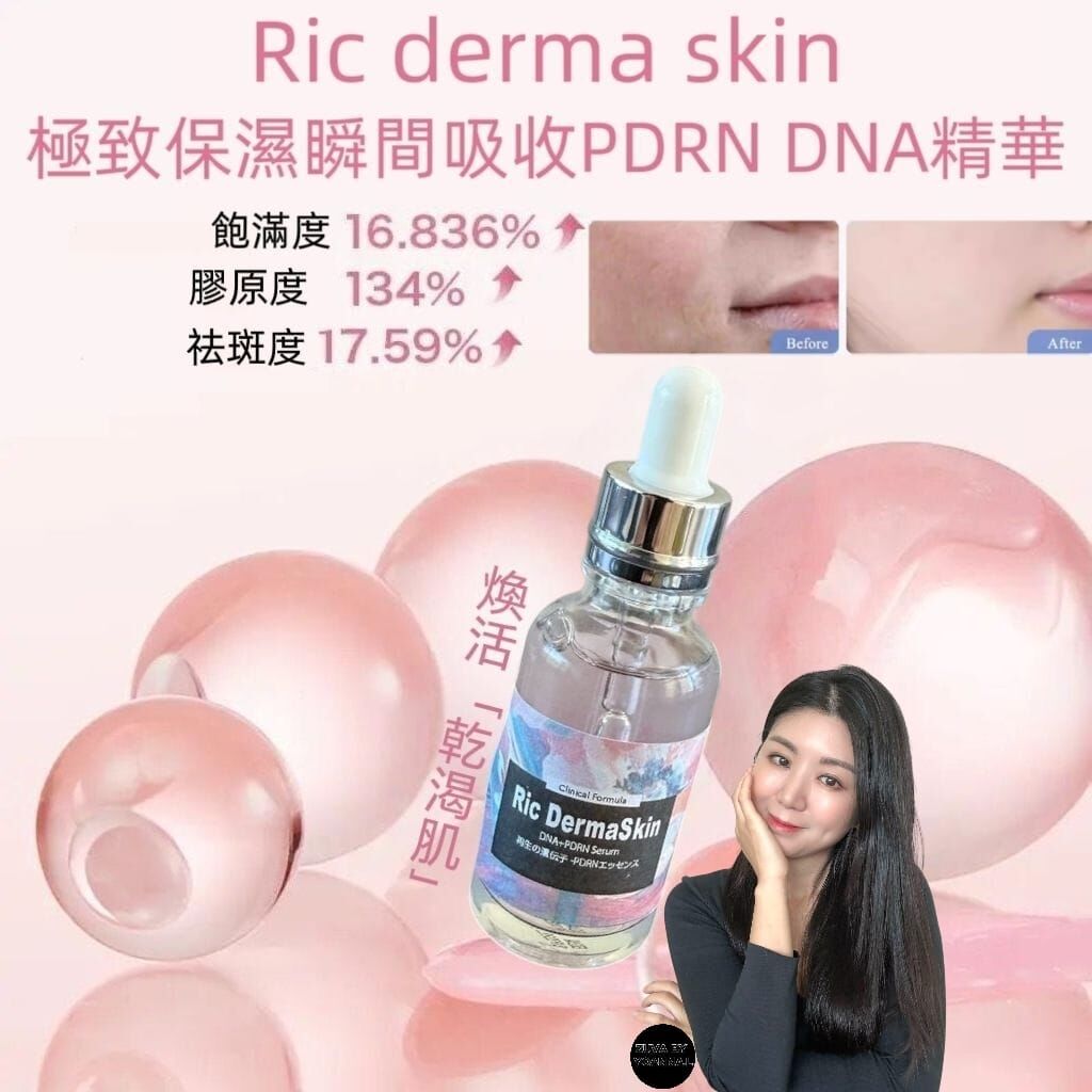 （PDRN重組DNA）Ric derma skin極致保濕 瞬間吸收PDRN DNA精華30ml R952☀️suki著數優惠Ric 精華買四送三☀️任選7件💢產品不予存貨，一次性推出少量優惠，敬請留意💢